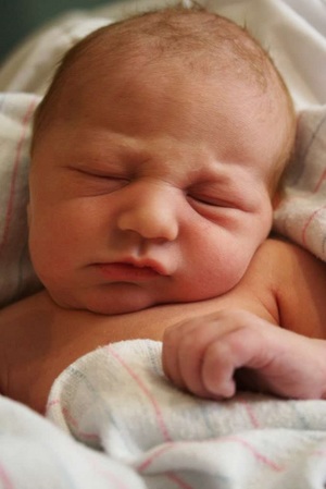 Новорожденный с перекосом шеи влево